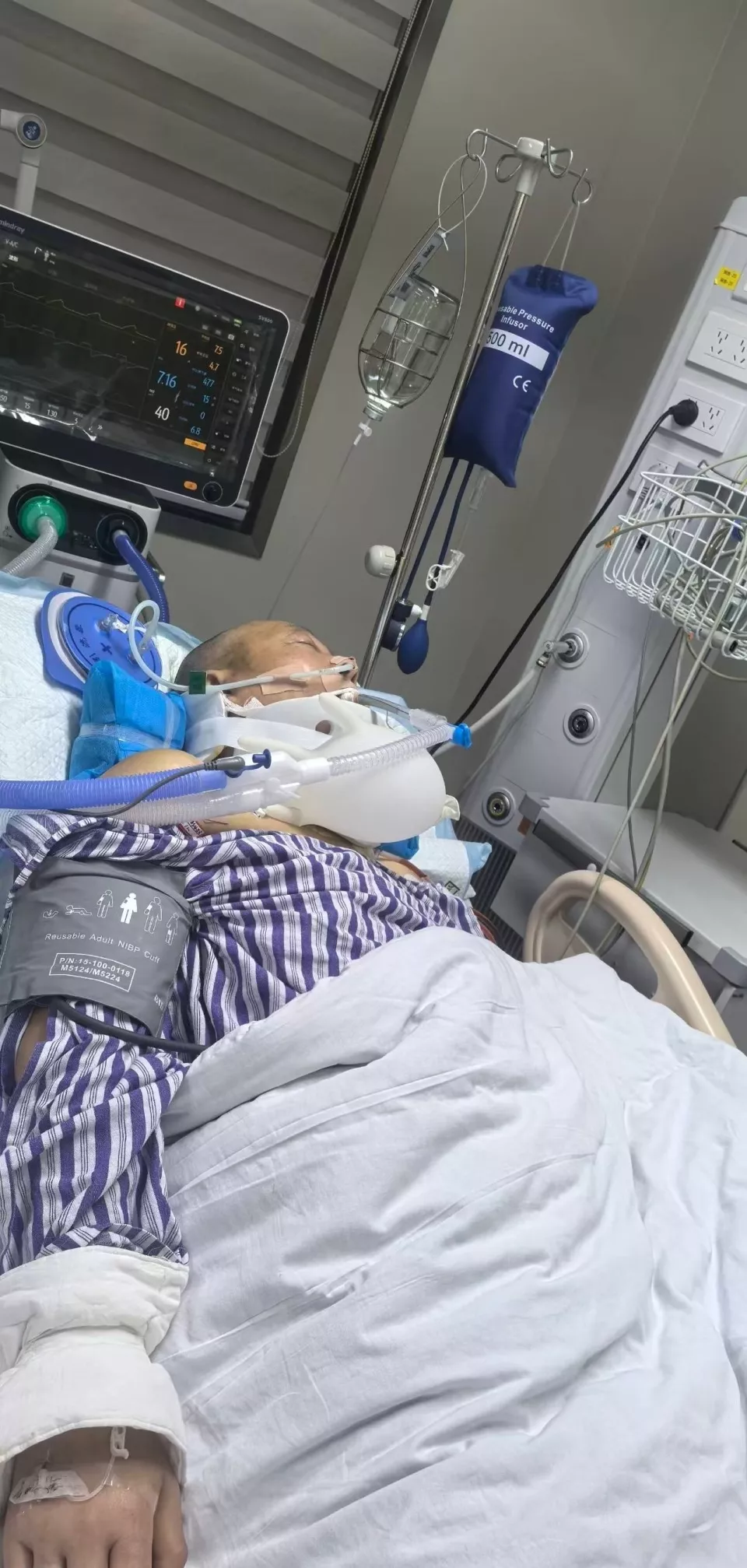 湖南男子健身时锁扣断裂被弹飞 致下肢瘫痪