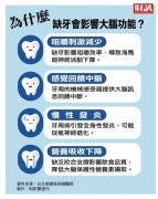 广泛缺牙为何会增加失智风险？牙齿正常咬合 是