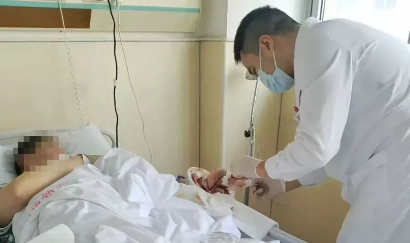 男子因油枪跳枪 衣裤沾上汽油未处理被烧成终身伤残